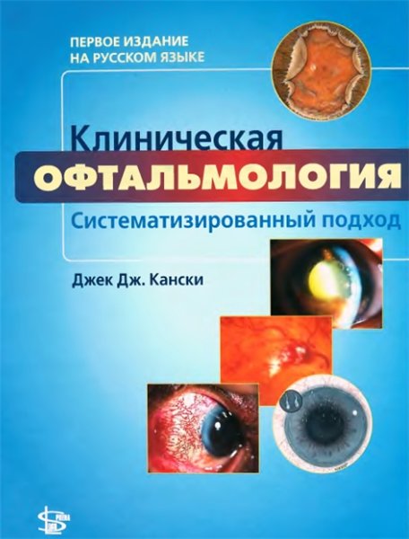 Джек Дж. Кански. Клиническая офтальмология